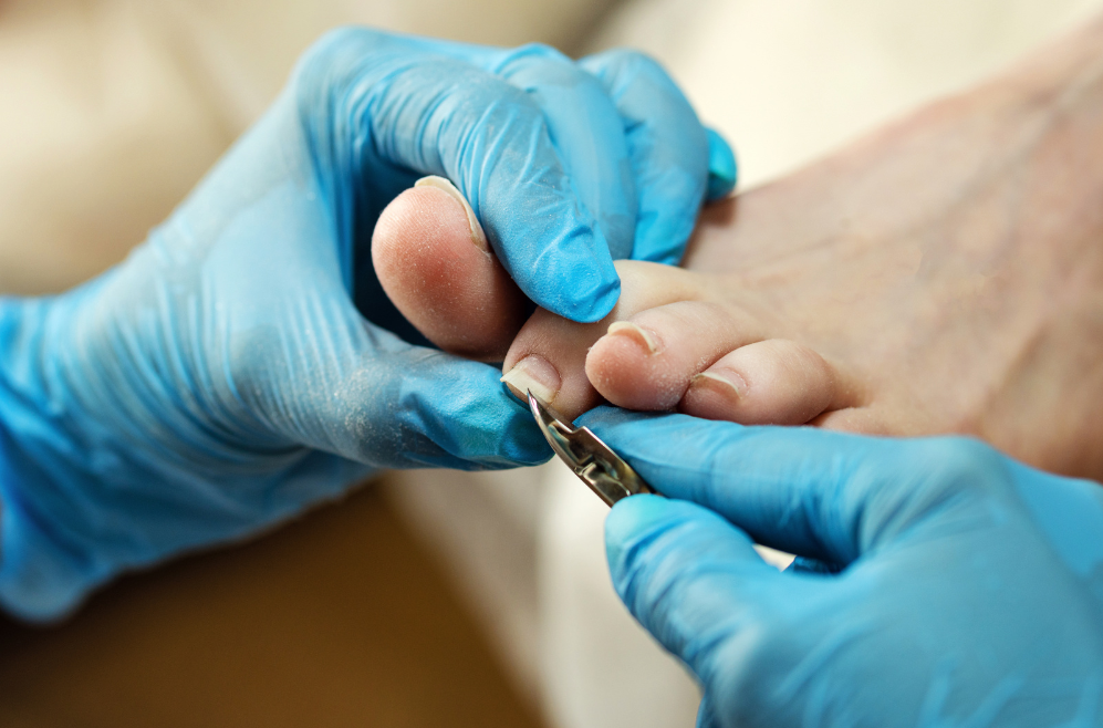 Podiatry vs. Chiropody: Is There a Difference? And Choosing the Right Practitioner in New Malden